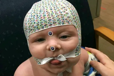 Baby wearing an EEG cap with electrodes attached to the face.