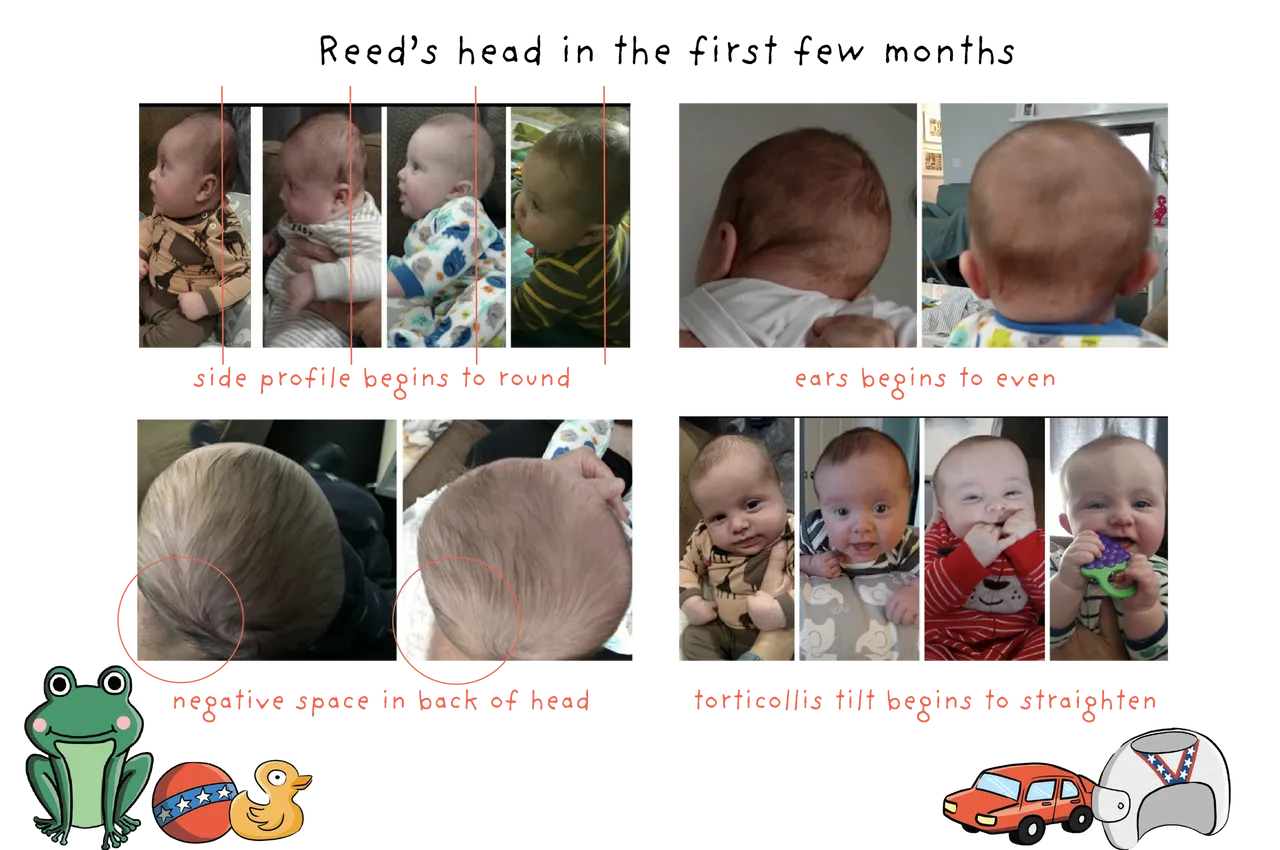 Comparative baby head shape images with emoji decorations.